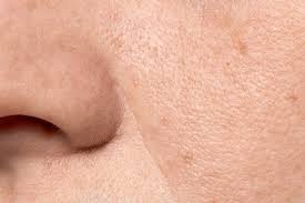 Mengungkap Rahasia Skincare untuk Mengecilkan Pori-pori: Kandungan yang Efektif dan Panduan Penggunaannya