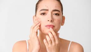 Skincare Tidak Cocok: Menemukan Solusi yang Tepat untuk Perawatan Kulit Anda