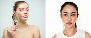 Skincare untuk Muka Kusam: Memulihkan Kecerahan Kulit dengan Perawatan yang Tepat