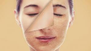 Mengatasi Kulit Wajah Kusam: Panduan Lengkap Skincare