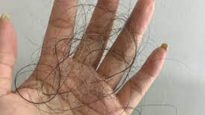 Skincare untuk Rambut Rontok: Mengatasi Masalah dengan Perawatan yang Tepat